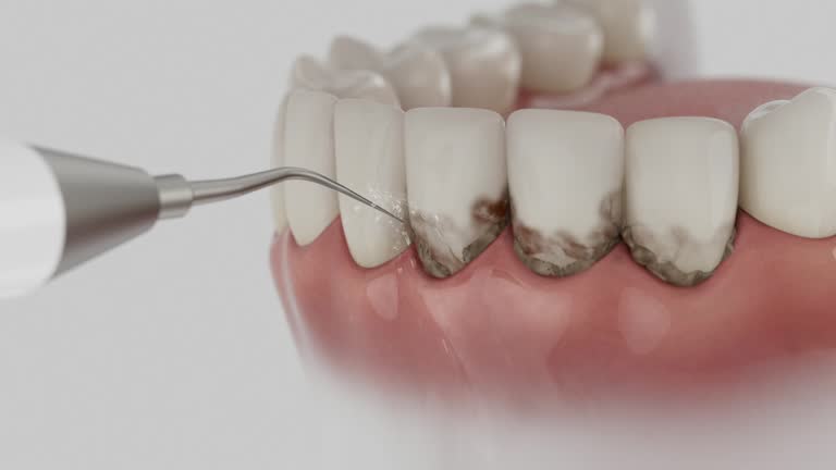 Reliable Dental Implants contractor in Kempner, TX by Smile Center Dentistry